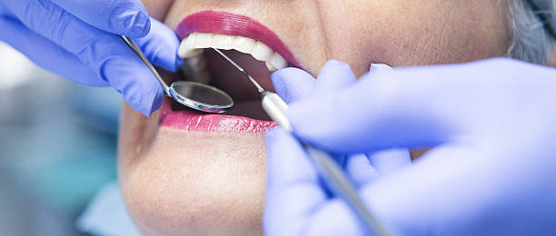 Best Emergency Root Canal Treatment in Greentown, IN
